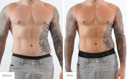 6 - Before and After Real Results of a man's torso from using the 3-in-1 Self Tanning + Sculpting Foam.